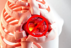 Ontsnap aan de pijn: ontdek de oplossingen voor hernia c5 c6 klachten