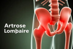 Bevrijd je rug: zeg vaarwel tegen arthrose lombaire pijn