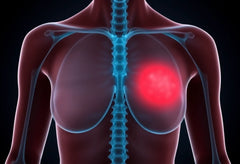 Verlicht ischias tijdens zwangerschap met deze effectieve tips