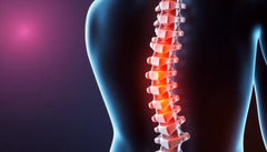 Oefenlezer: ontdek oefeningen voor verlichting bij spondylose