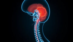 Verlicht de pijn van torticollis: ontdek de beste oplossingen