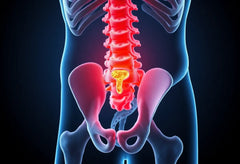 Verlicht je rugpijn: ontdek de oplossingen voor l4 l5 hernia