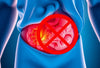 Wat kost een hernia-operatie echt? Ontdek de verborgen kosten en verrassingen!