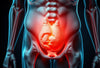 Hernia: herken de stille signalen en voorkom complicaties