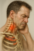 Hoe lang duurt een arthrose cervicale-crisis echt? Ontdek de feiten!