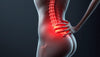 Oefenlezer: ontlast je linkerbeen met deze essentiële sciatica-oefeningen